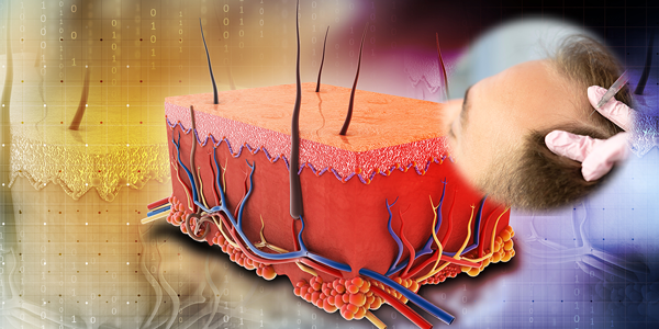 G Cell Otolog Micrograft Tekniği